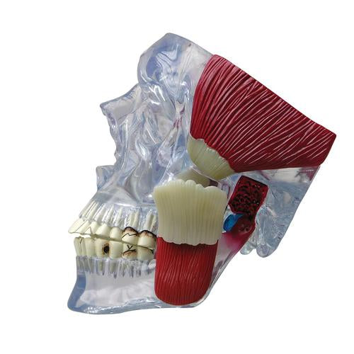 Állkapocsízület-modell (TMJ)