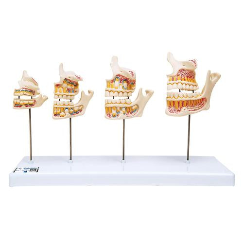 A fogazat fejlődése