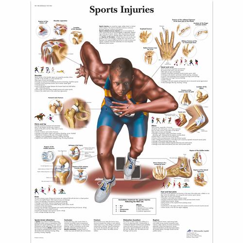 Sportsérülések, laminált falikép (angol nyelvű)