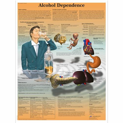 Alkoholfüggőség, papír falikép (angol nyelvű)