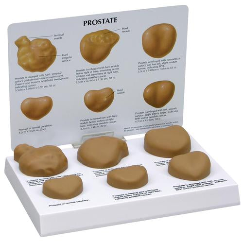 Prosztatamodell