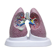 Lung Set with Pathologies